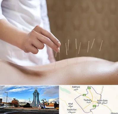 درای نیدلینگ در تایباد