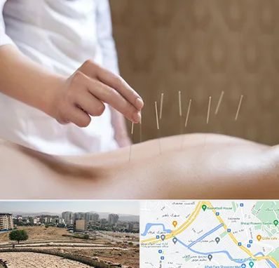 درای نیدلینگ در کوی وحدت شیراز 