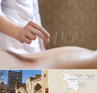 درای نیدلینگ در تربت جام
