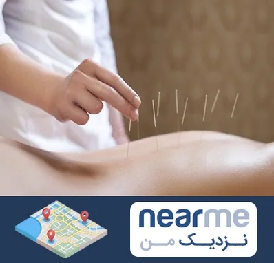 درای نیدلینگ در نزدیک من