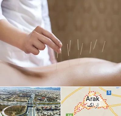 درای نیدلینگ در اراک