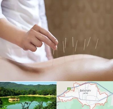 درای نیدلینگ در بهشهر