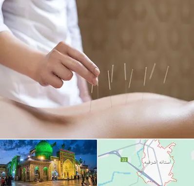 درای نیدلینگ در آستانه اشرفیه