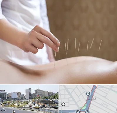 درای نیدلینگ در هفت تیر