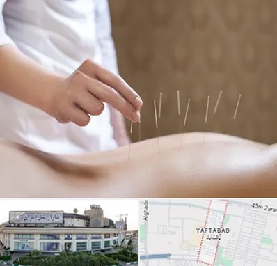 درای نیدلینگ در یافت آباد