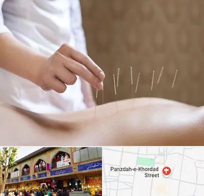 درای نیدلینگ در 15 خرداد