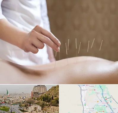 درای نیدلینگ در فرهنگ شهر شیراز 