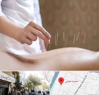 درای نیدلینگ در مجیدیه جنوبی