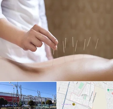 درای نیدلینگ در فاز دو اندیشه