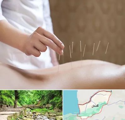 درای نیدلینگ در گلستان
