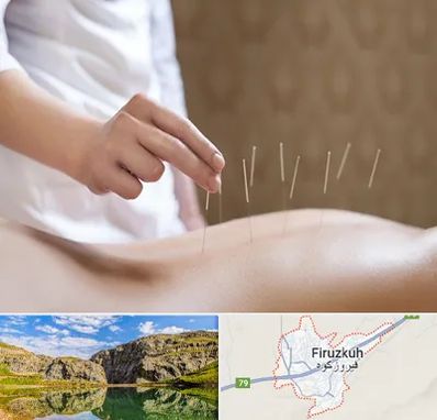 درای نیدلینگ در فیروزکوه