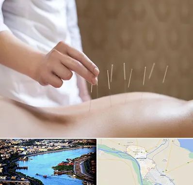 درای نیدلینگ در خرمشهر