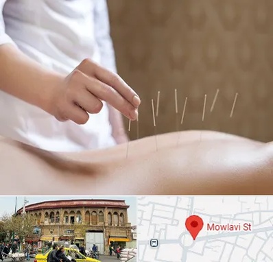 درای نیدلینگ در مولوی