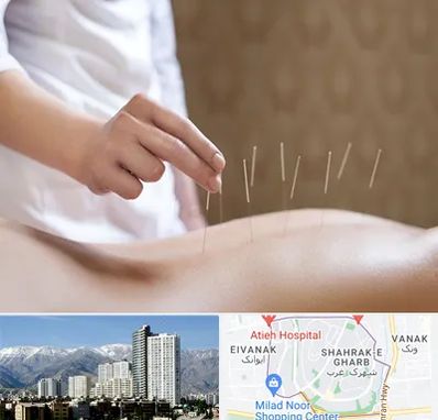 درای نیدلینگ در شهرک غرب 