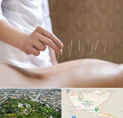 درای نیدلینگ در شهرکرد