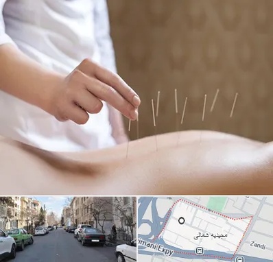 درای نیدلینگ در مجیدیه شمالی