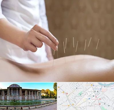 درای نیدلینگ در عفیف آباد شیراز 