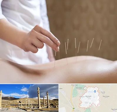 درای نیدلینگ در مرودشت