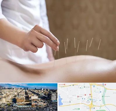 درای نیدلینگ در شهرک راه آهن 