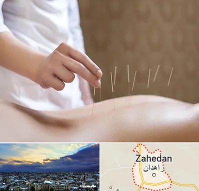 درای نیدلینگ در زاهدان