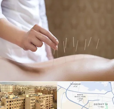 درای نیدلینگ در جنوب غرب تهران
