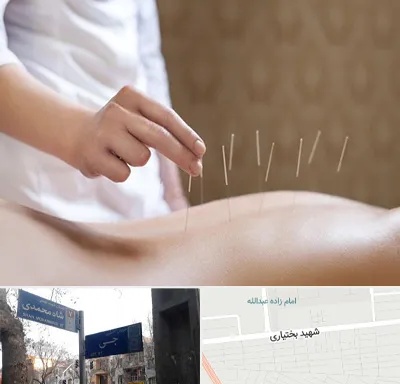 درای نیدلینگ در سی متری جی