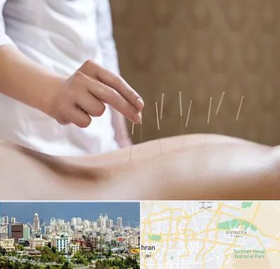 درای نیدلینگ در شرق تهران 