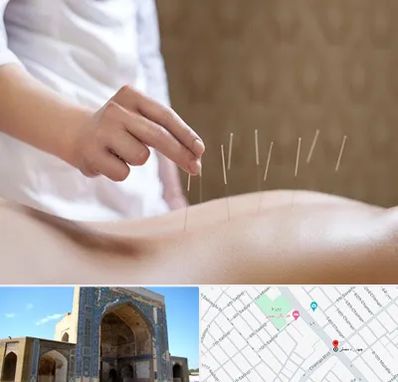 درای نیدلینگ در مصلی مشهد