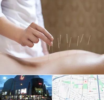 درای نیدلینگ در بلوار اباذر