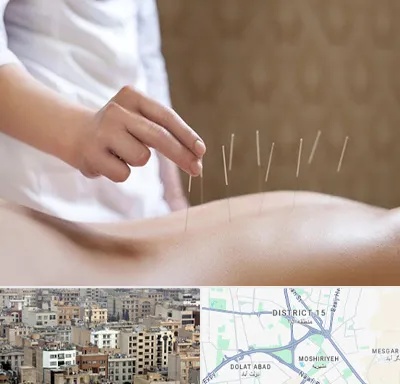 درای نیدلینگ در جنوب شرق تهران