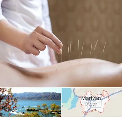 درای نیدلینگ در مریوان