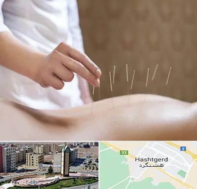 درای نیدلینگ در هشتگرد