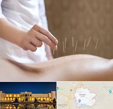 درای نیدلینگ در برازجان