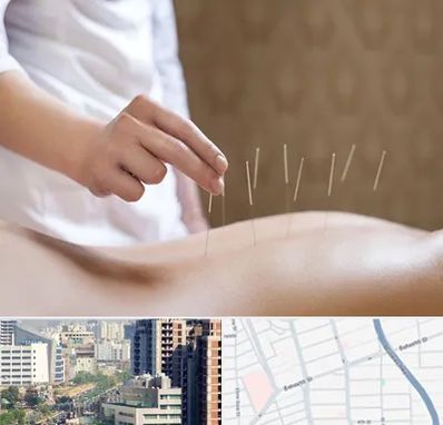 درای نیدلینگ در خیابان بهشتی