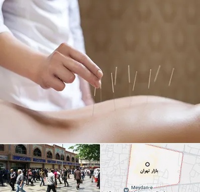 درای نیدلینگ در بازار تهران