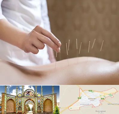 درای نیدلینگ در سمنان