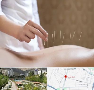 درای نیدلینگ در بلوار تعاون