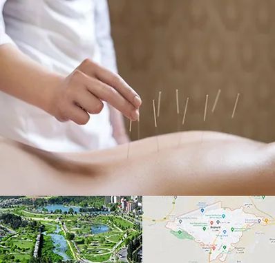 درای نیدلینگ در بجنورد