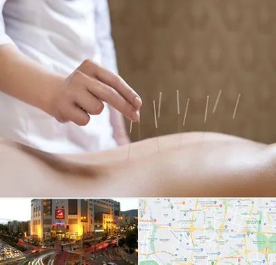 درای نیدلینگ در جنت آباد تهران 