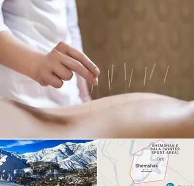 درای نیدلینگ در شمشک