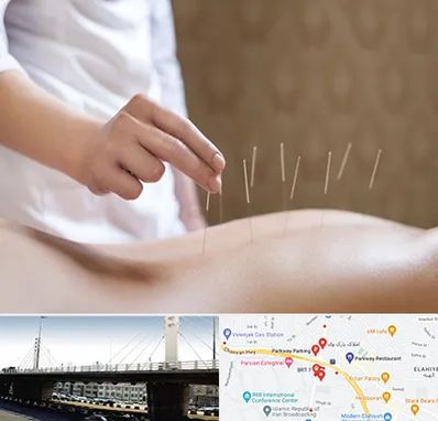 درای نیدلینگ در پارک وی 