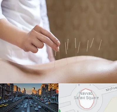 درای نیدلینگ در نواب 