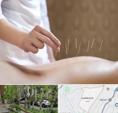 درای نیدلینگ در دروس