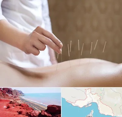 درای نیدلینگ در هرمزگان