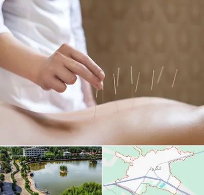 درای نیدلینگ در لنگرود