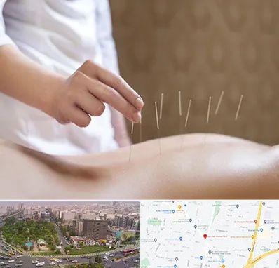 درای نیدلینگ در آیت الله کاشانی 