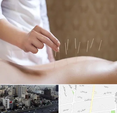 درای نیدلینگ در زرتشت