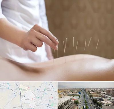 درای نیدلینگ در حصارک کرج 