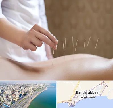 درای نیدلینگ در بندرعباس