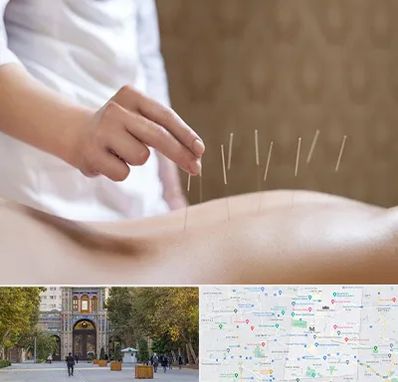 درای نیدلینگ در منطقه 12 تهران 